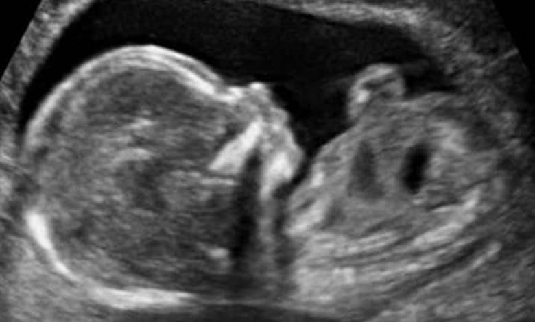 Hamilelikte 14 Haftalık Gebelik Bebek Kilosu